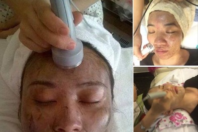 Công nghệ hút chì cho da chỉ là... “chém gió”?